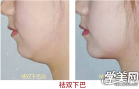 https://www.exuemei.com/show-10-1262-1.html