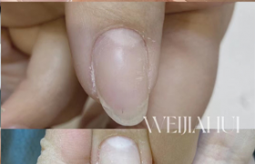 https://www.exuemei.com/show-10-1264-1.html