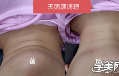 体态骨雕塑形-高级班