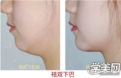 面部驻颜精雕-精修班
